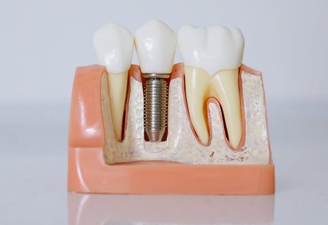 Why Experts Now Say Not to Remove Your Wisdom Teeth: New Insights