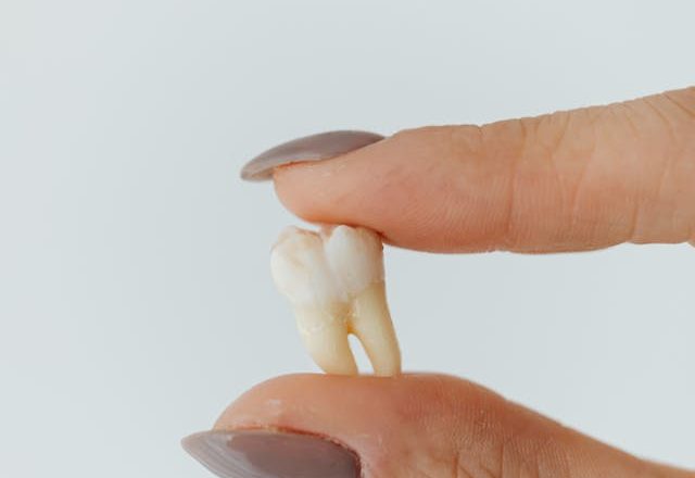 Worst Day of Pain After Wisdom Tooth Extraction: Tips and Relief