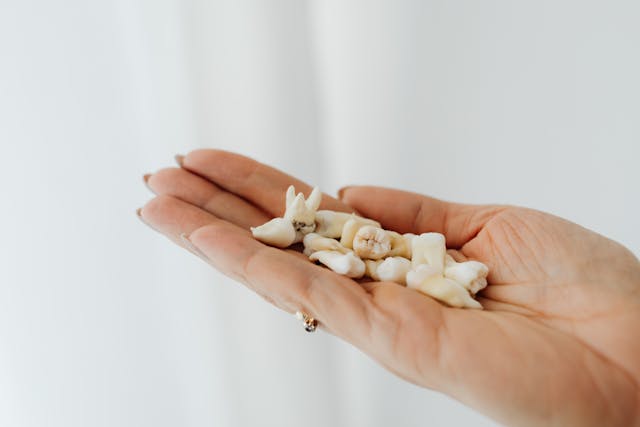 Why Experts Now Say Not to Remove Your Wisdom Teeth: New Insights